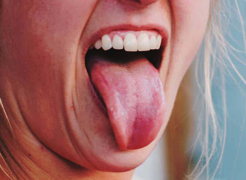 Une bouche acide peut-elle provoquer des caries